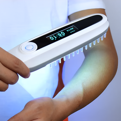 SolariShine Home Phototherapy Lamp for Vitiligo, Eczema, and Psoriasis