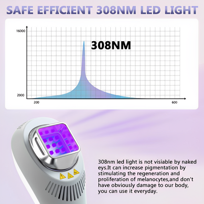 TreatSmart 308nm UVB Phototherapy Lamp for Vitiligo and Psoriasis